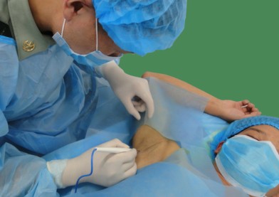 开始手术 开始手术.jpg